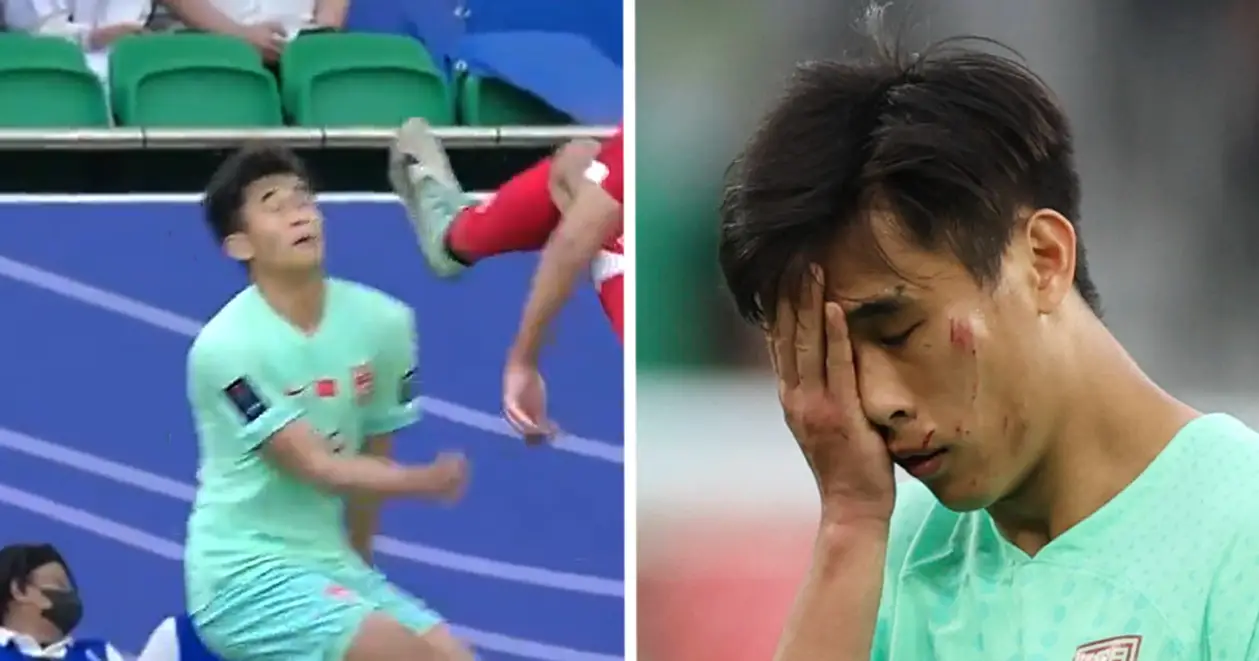 😦 Моторошний момент з Кубка Азії: гравцю збірної Китаю вдарили шипами в обличчя, але арбітр навіть не свиснув