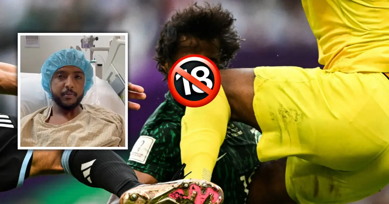 Як зараз виглядає захисник Саудівської Аравії, що отримав моторошну травму у матчі з Аргентиною. У мережі з'явилось відео