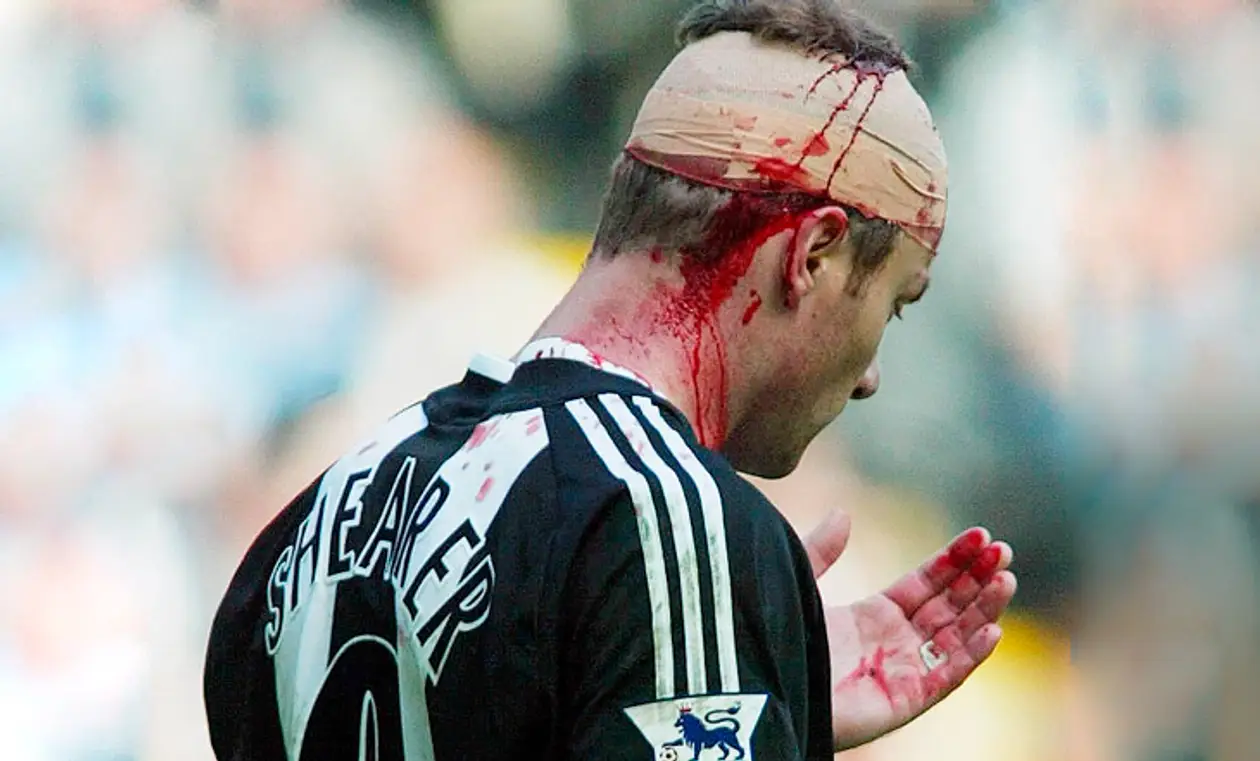 Есть ли связь между ударами головой в футболе и повреждениями мозга?