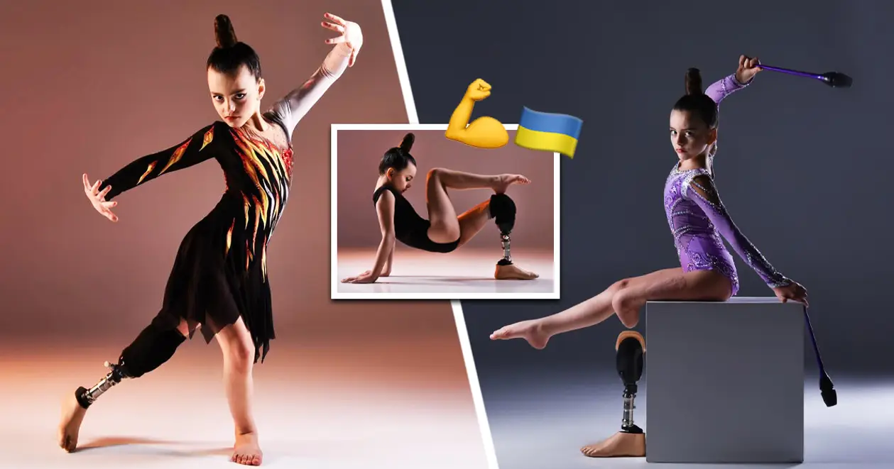 💔 Сила українського духу: маленька гімнастка, яка втратила ногу внаслідок російського обстрілу, продовжує займатися спортом