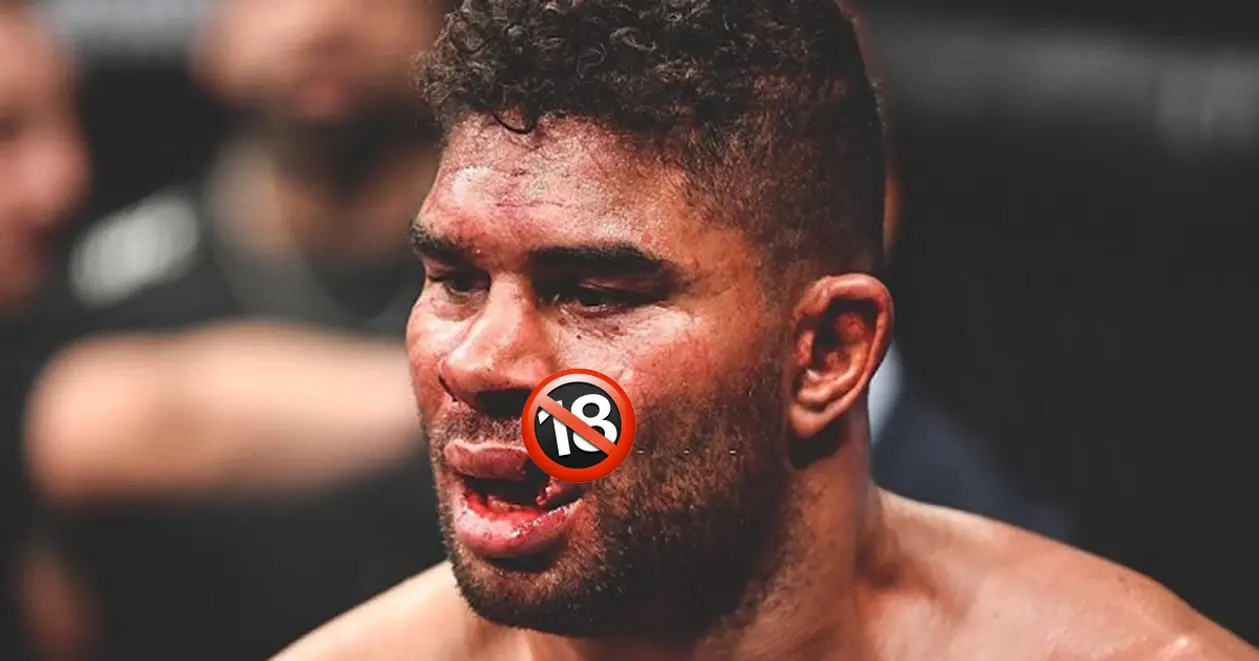 😱 Жесть дня: легенде ММА разорвали губу во время поединка в UFC