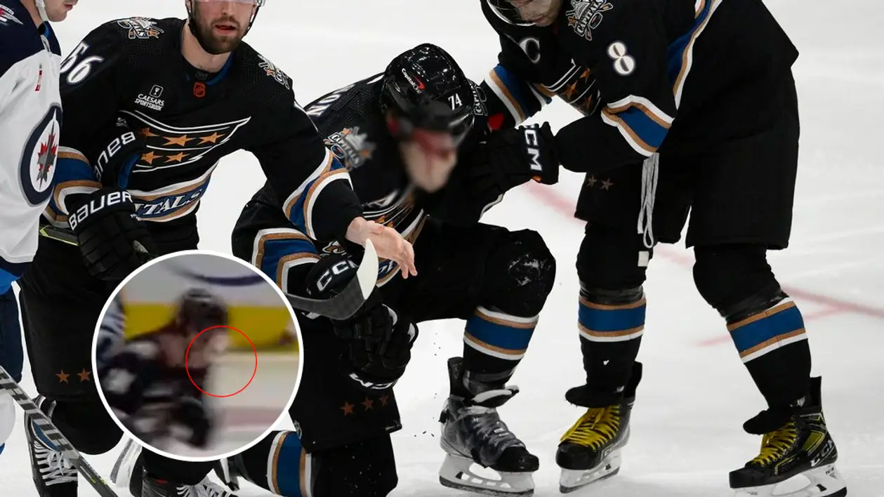 Ох. Кривава травма в НХЛ – захиснику влучили в обличчя шайбою, він не зміг продовжити гру