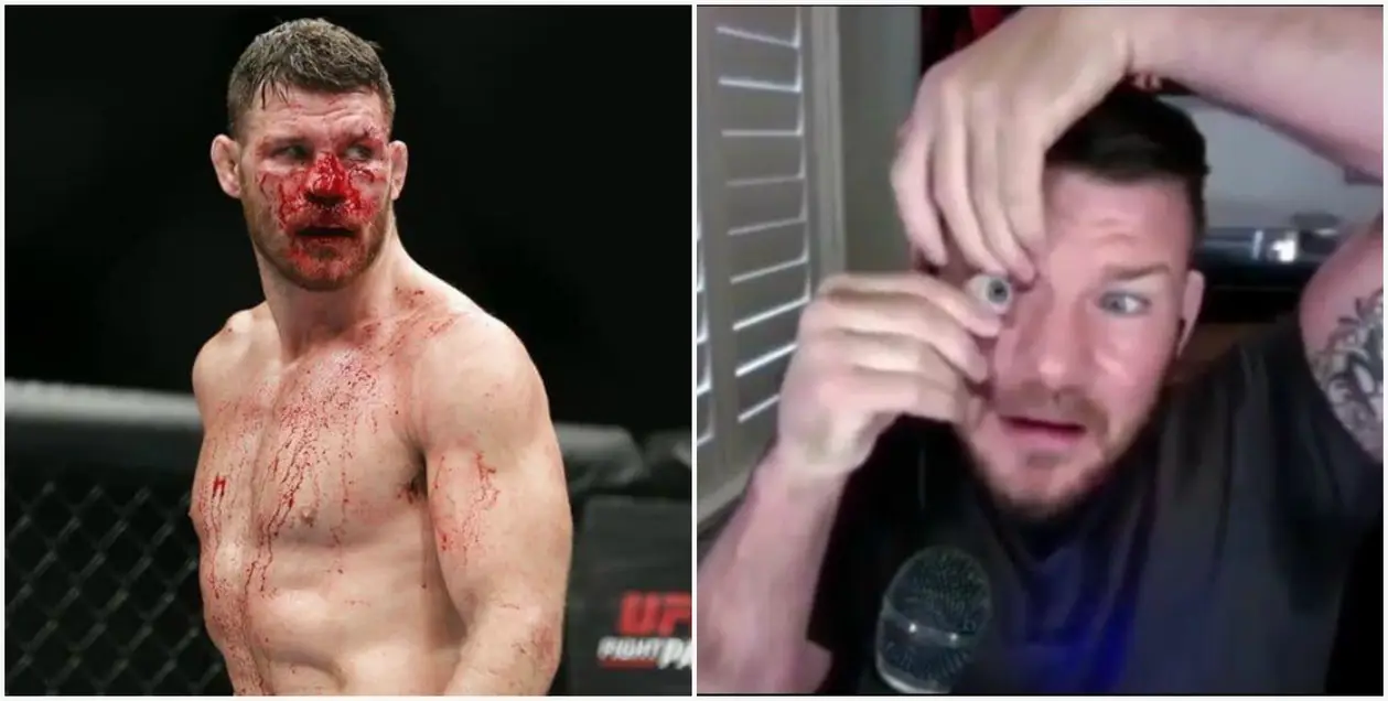 Экс-чемпиона UFC достали вопросы о солнечных очках. Он достал глаз в прямом эфире