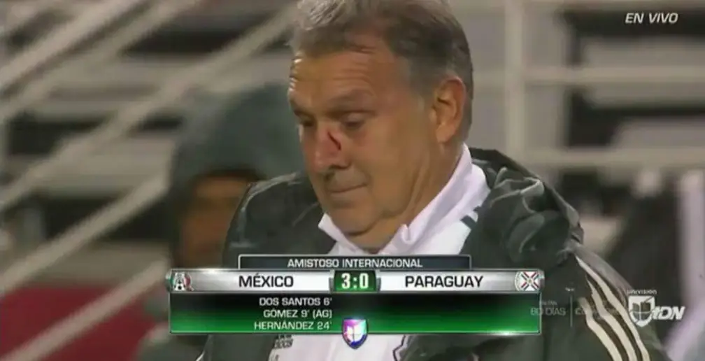 Тренер Парагвая попал мячом в лицо Херардо Мартино. Но все закончилось улыбками