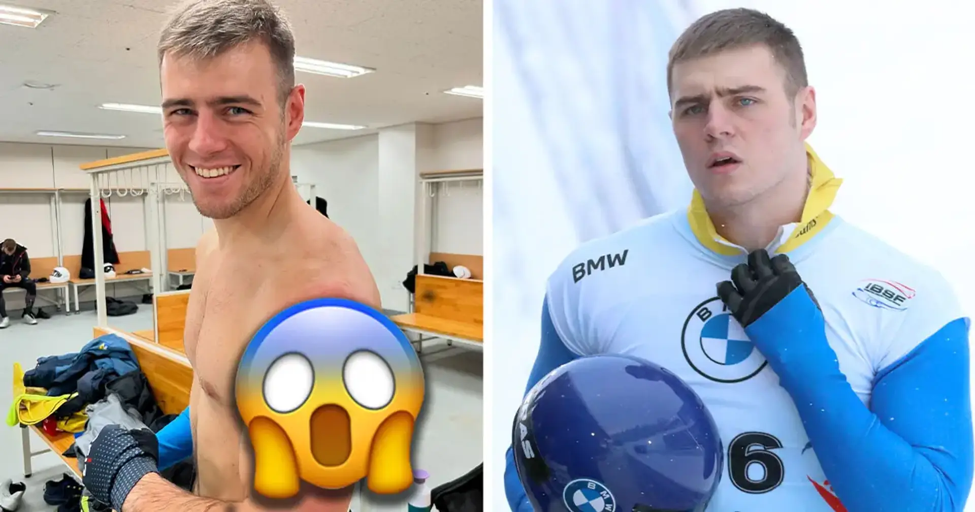 🥶 «Така ціна досвіду у скелетоні». Гераскевич показав травмовану під час тренування руку